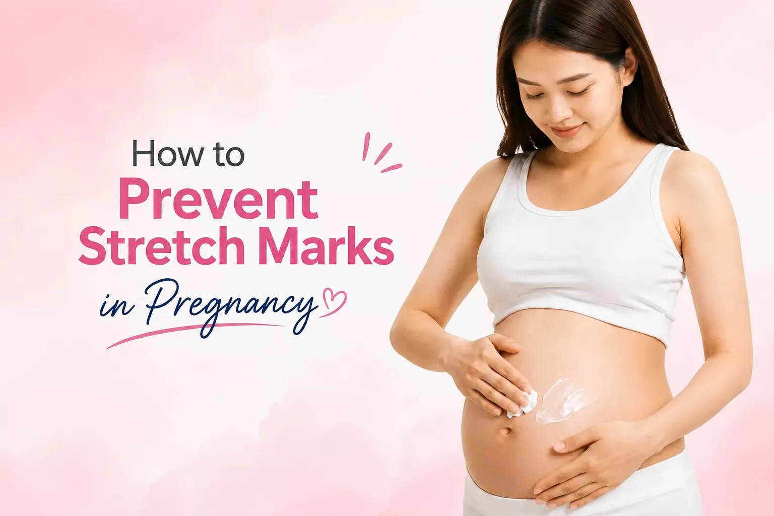 Stretch Marks in Pregnancy
