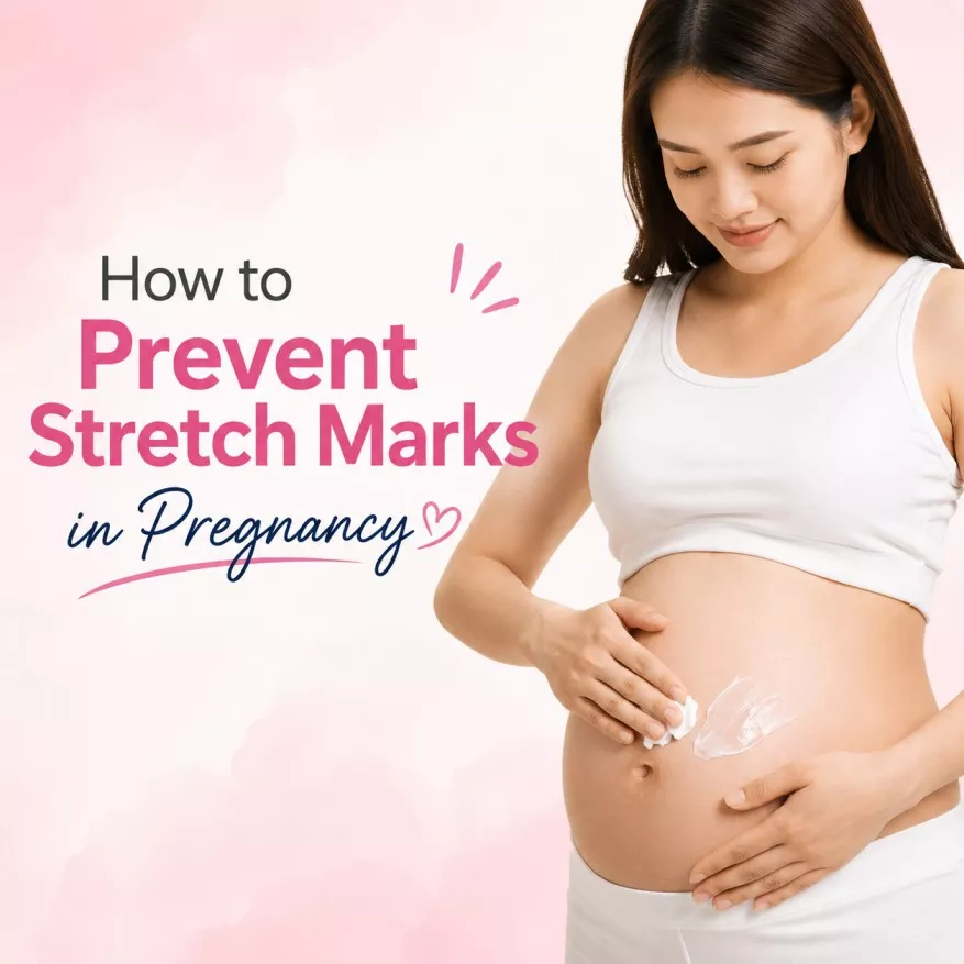 how to prevent stretch mark in pregnancy with natural body care